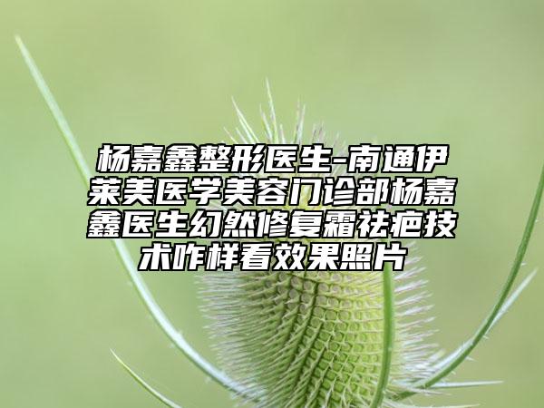 楊嘉鑫整形醫(yī)生-南通伊萊美醫(yī)學美容門診部楊嘉鑫醫(yī)生幻然修復霜祛疤技術(shù)咋樣看效果照片