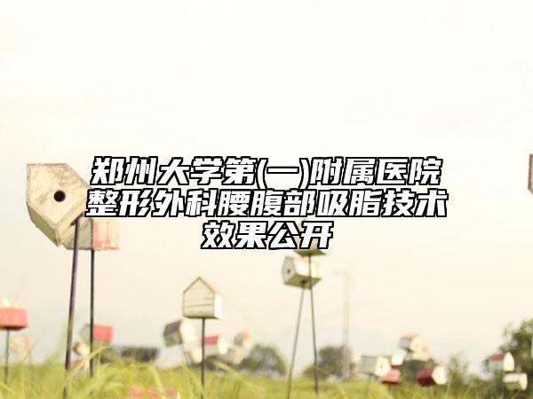鄭州大學第(一)附屬醫(yī)院整形外科腰腹部吸脂技術效果公開